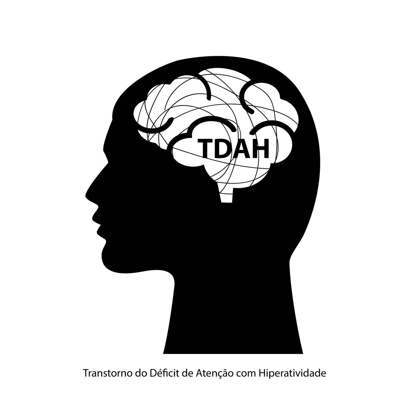 Leia mais sobre o artigo O que é tdaH? sintomas e tratamento. como saber se você ou seu filho tem.